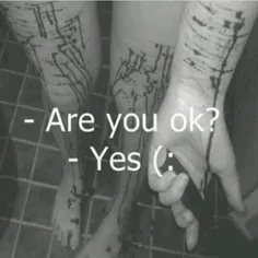 +are you ok?