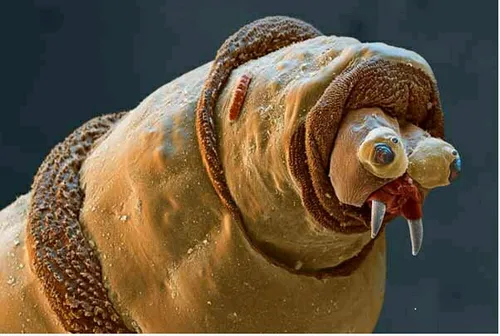 چه خنگه 😂 چندش آورترین تصاویر از دنیای میکروسکوپی