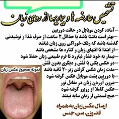 ،تا حالا به زبونت 👅 تو آینه نگاه کردی؟🤔