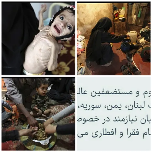 🔴 😔 گرسنگی در یمن بی داد می کند...