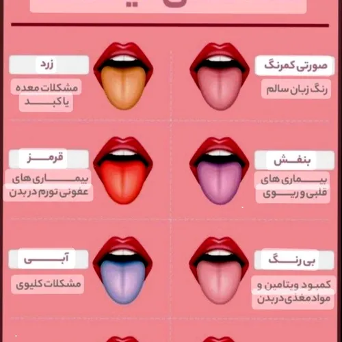 💥رنگ زبان و وجود بیماری در سایر اندام ها💥