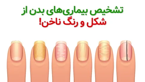 📌سلام دوستان در خدمت تون هستم با مبحث ناخن شناسی 💅