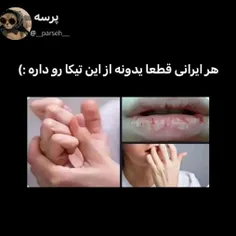 منکه همشو دارم:))