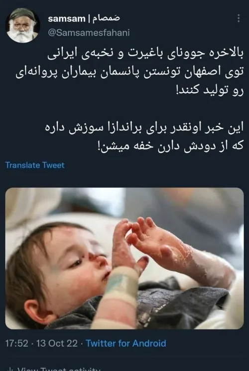 بالاخره جوونای باغیرت و نخبه ی ایرانی توی اصفهان تونستن پانسمان بیماران پروانه ای رو تولید کنند