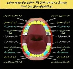 🔴 درد هر دندان و پوسیـــــدگی آن زنگ خطری است برای وجود ب