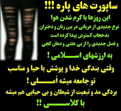 🔴 ساپورت های پاره❗ ❗ ❗ ❗