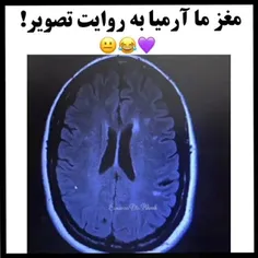 کی از مغز من عکس گرفته؟ 