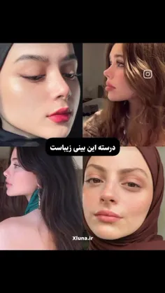 هرکی زیبایی داره و قابل مقایسه نیست😭💕