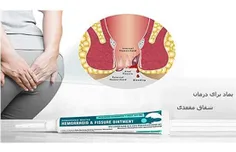 درمان شقاق مقعدی با روش‌های دارویی و پزشکی