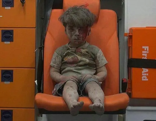 پسرپنج ساله سوری که دیروز دربمباران حلب به خاک و خون آلود