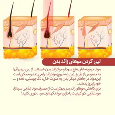 اگر قصد دارید موهای زائد بدنتان را لیزر کنید، بدانید❗ ️