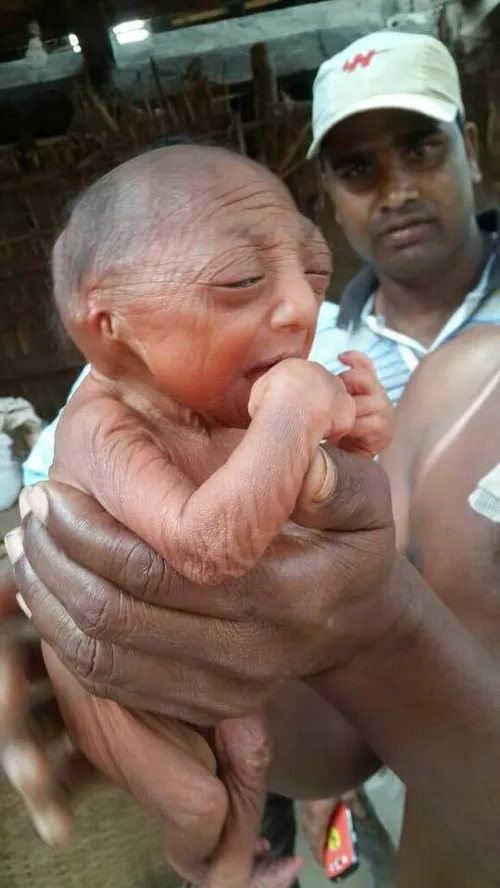 این نوزاد کوچولو که از ظاهرش پیداست کارشناس ها تشخیص دادن