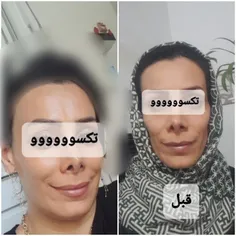 چقدر لذت‌بخشه از راه طبیعی بتونی صورت چاق و تپلی رو برا خ