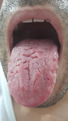 تحلیل زبان 👅