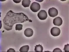گلبول سفید در تعقیب باکتری
