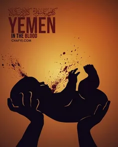 #Yemen 