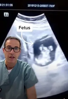 شوکه شدن پزشکان از رشد جنین در کبد زن کانادایی!