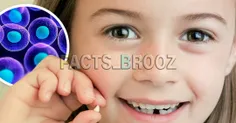 دندان شیری کودکان حاوی سلول بنیادی است که میتوان آن را به