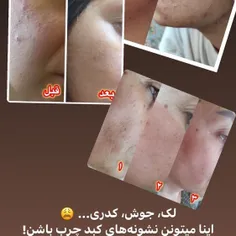 روغن خالص کاژان لکه پوستی