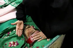 📸 تصویری از دستان آغشته به خون مادر شهید #محمدحسین_حدادیا