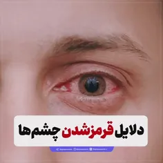 دلایل قرمزشدن چشم‌ها و زمانی که باید به اورژانس مراجعه کر