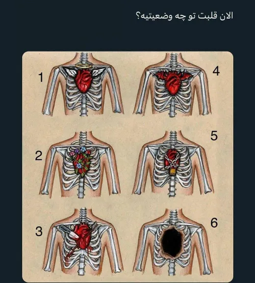 الان قلبت تو چه وضعیه ؟