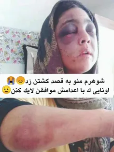 خوشونت علیه زنان شوهرش ب قصد کشتن کتکش زده اگه موافقین که