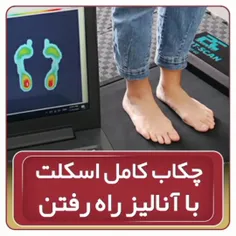 چکاب کامل اسکلت با آنالیز راه رفتن 