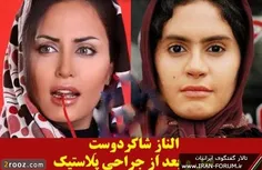 حالا هی بگید الناز اِله الناز بِله 