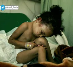 ⭕ ️ طبق گزارش نیویورک تایمز در یمن هر ۵دقیقه ۱کودک جان می