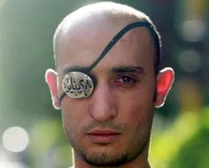 احمد البلاسی جوان 31 ساله مصری كه در جریان انقلاب این كشو