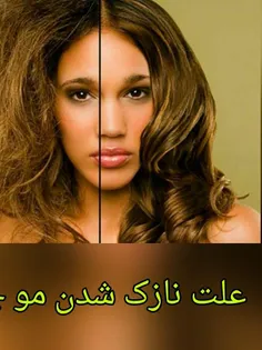 علت#نازک_شدن_مو چیه؟ نشانه‌ای از "بیش فعالی غده #تیروئید"