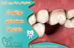 عواقب از دست دادن دندانها