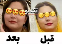 #پکیج تپلی صورت🔥🤩