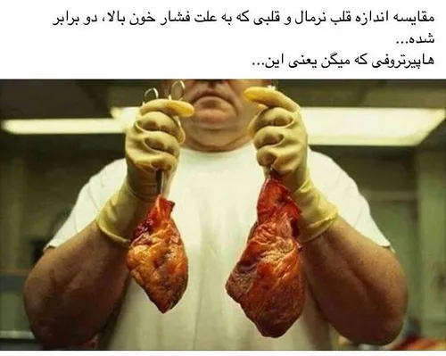 فشار خون جدی بگیرید .....