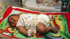 سنگین ترین نوزادجهان درهند ب دنیا آمد.۶ کیلو