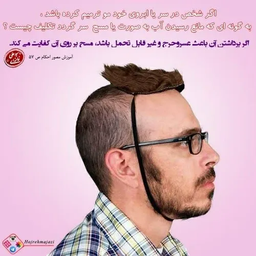 وظیفه شخصی که در سر یا ابروی خود مو ترمیم کرده باشد