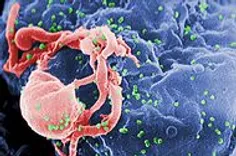 تصویر ریزنگاری‌شده از ویروس HIV-1 (به رنگ سبز) که به صورت