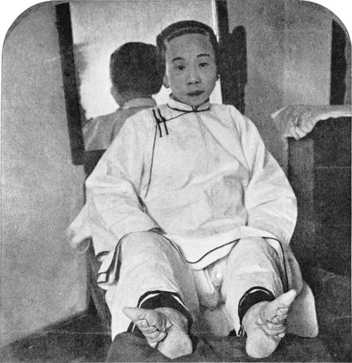 ⛔ ️⛔ ️📵 دختر چینی که بر اساس یک سنت تاریخی، پاهایش کوچک ش
