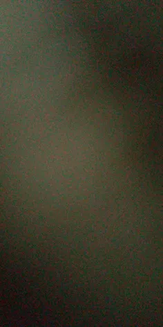 عکس زیربغل مار که توسط فرکام گرفته شد