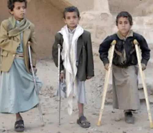 ‼ ️ هشتاد هزار کودک یمنی را کشتند