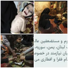 🔴 😔  گرسنگی در #یمن بی‌داد می‌کند...