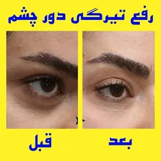 معجزه کرم شب لازان 