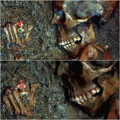 جسد یکی از قربانیان فوران آتشفشان "وزوو" که در شهر باستان