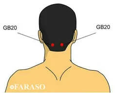 نقطه GB20 در سردردهای تنشی و میگرنی که از ناحیه پشت سر شر