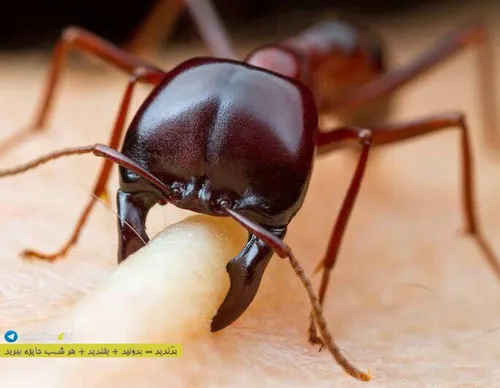 اینم تصویر نزدیک از گاز گرفتن مورچه