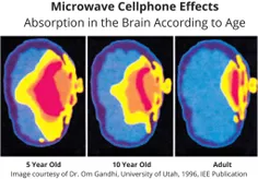 جذب امواج موبایل توسط مغز کودک بعد از 5 دقیقه صحبت با آن