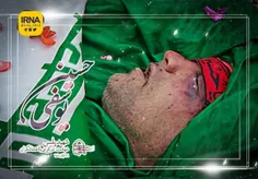 📸 اولین تصویر از چهره کبود شهید مدافع وطن «حسین یوسفی»