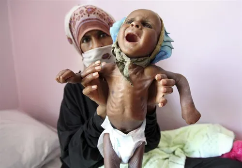 ⭕ ️ مسئول هماهنگ کننده سازمان ملل در یمن: بیش از ۸ میلیون