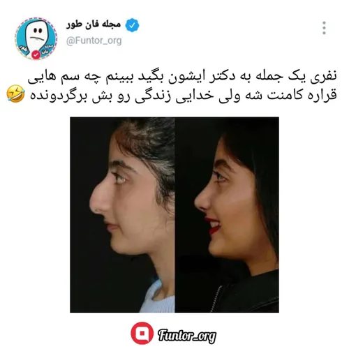  minaa6969 56482204 - عکس ویسگون